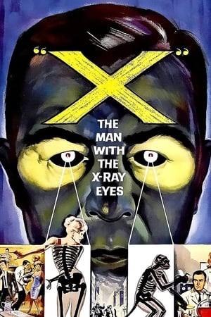 Image X: The Man with the X-Ray Eyes