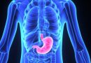 3 ways to help people with stomach ulcers