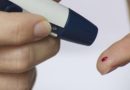 Elevated blood glucose prone to pimples