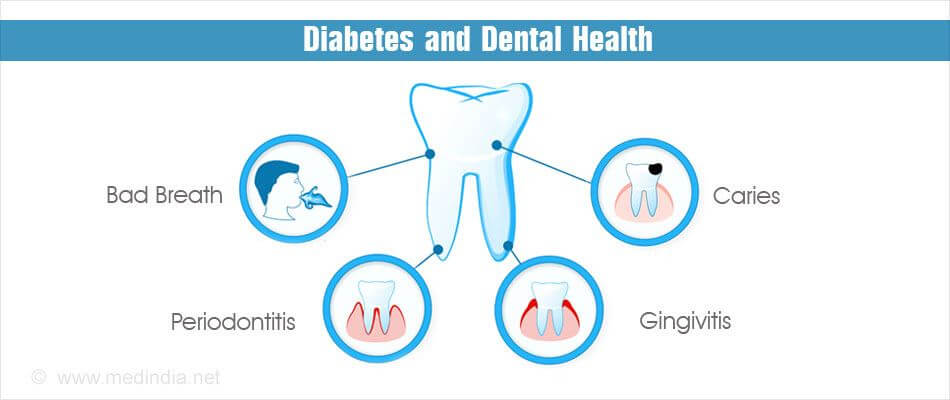 Periodontal Disease And Diabetes – What You Need To Know