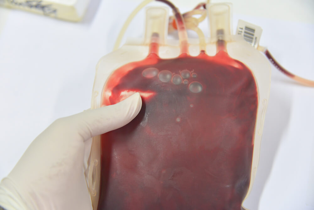 Tipos de anemia: entenda quais são as diferenças existentes