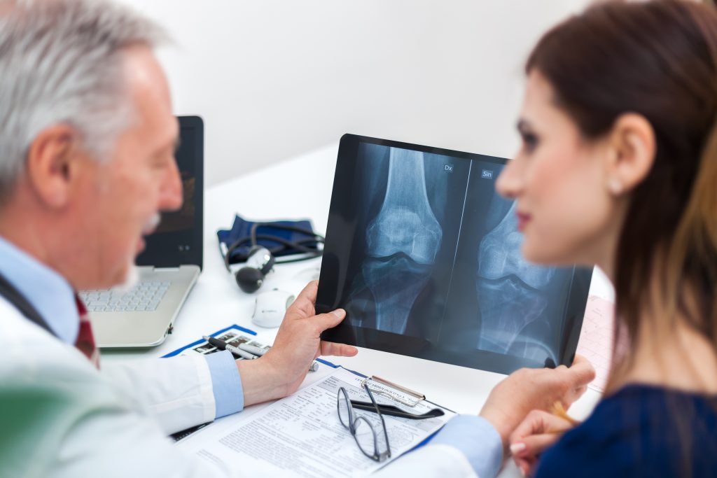 Entenda como funciona o tratamento para osteoporose