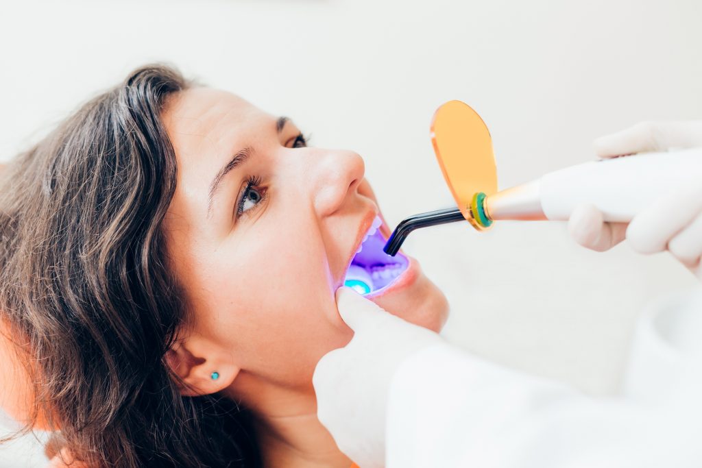 9 mitos e verdades sobre clareamento dental