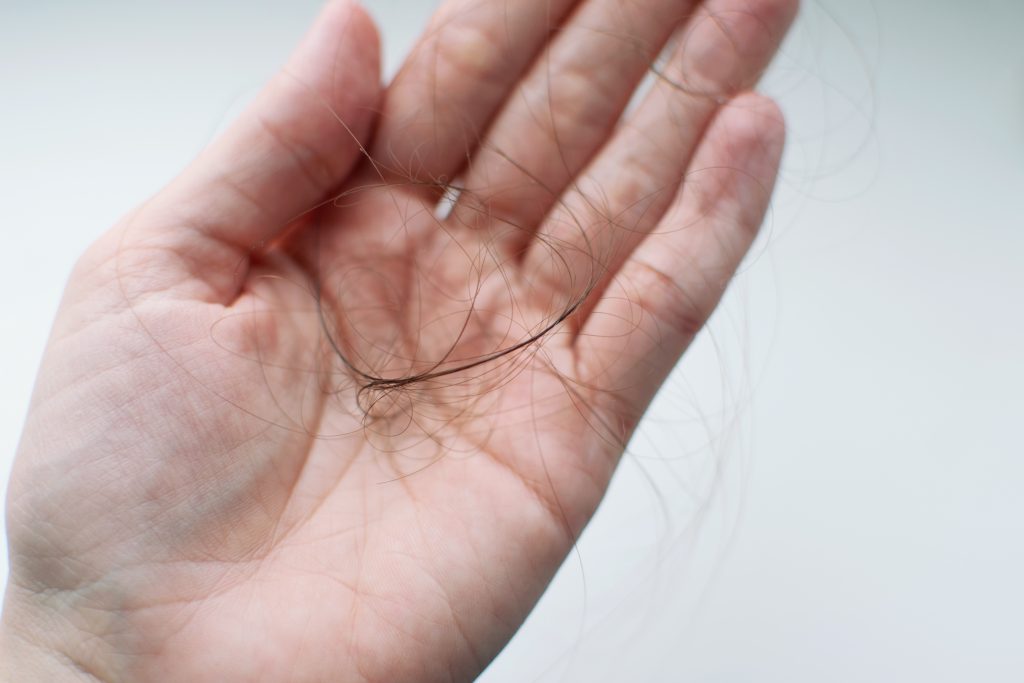 Queda de cabelo: suas causas e formas de prevenção