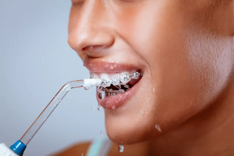 Best Water Flosser For Braces - How To Use Water Flosser With Braces