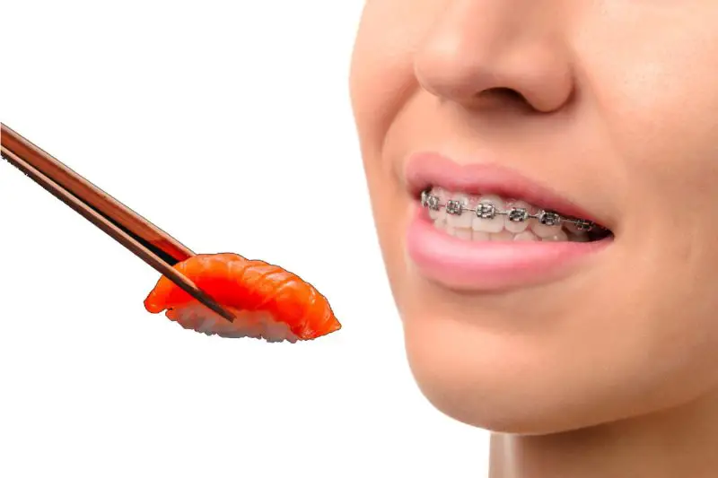 Can You Eat Sushi With Braces
