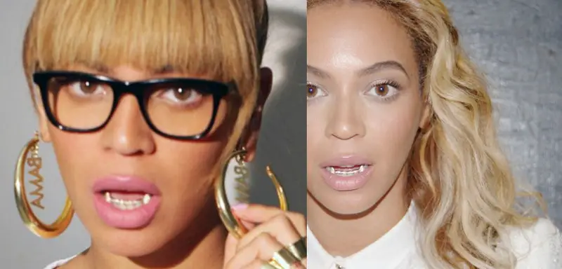 Did Beyonce Have Braces - Beyonce With Grillz
