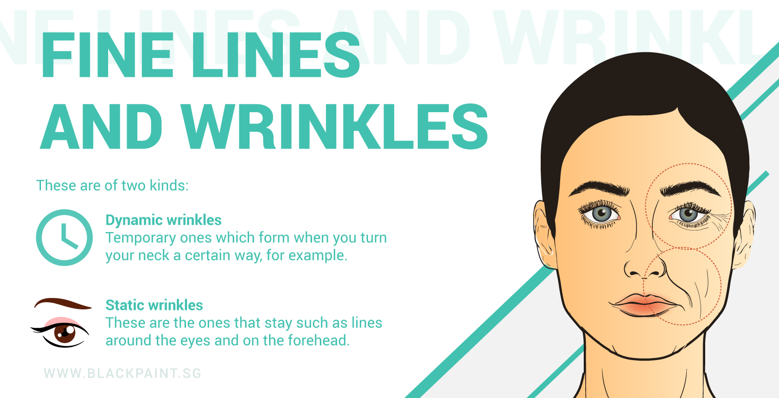 illustration of 2 types of wrinkles that you should know about
