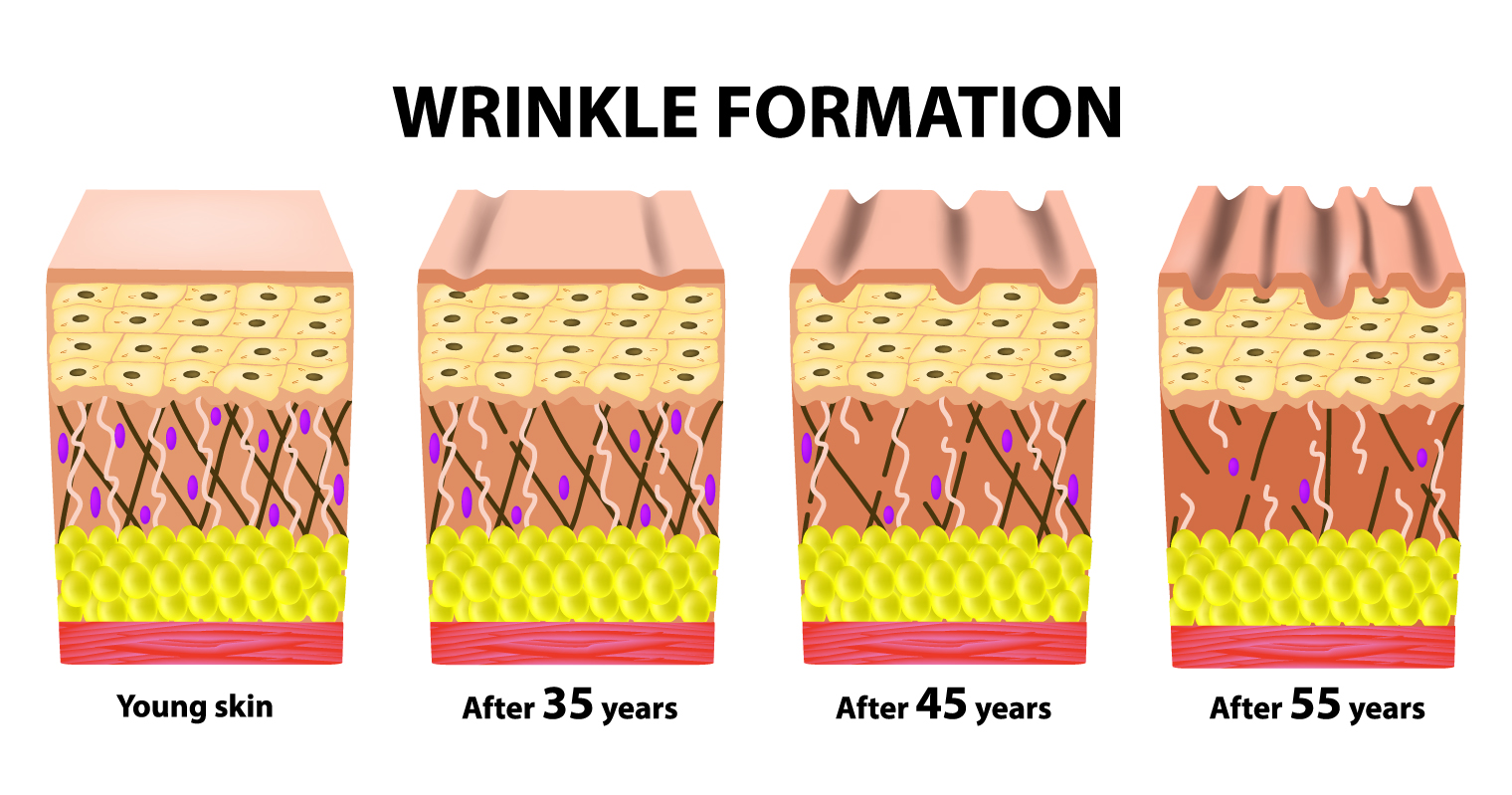 loss of collagen wrinke formation