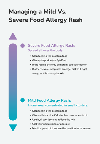 Does My Baby Have A Food Allergy Rash Ready Set Food