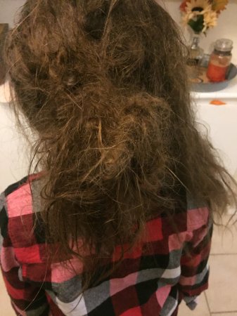 How To Untangle Severely Matted Hair Detangle Biracial Caucasian Hair Kizaiacare Pro