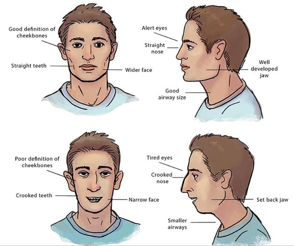 Les Appareils Pour Entrainer Sa Machoire Musclersonvisage