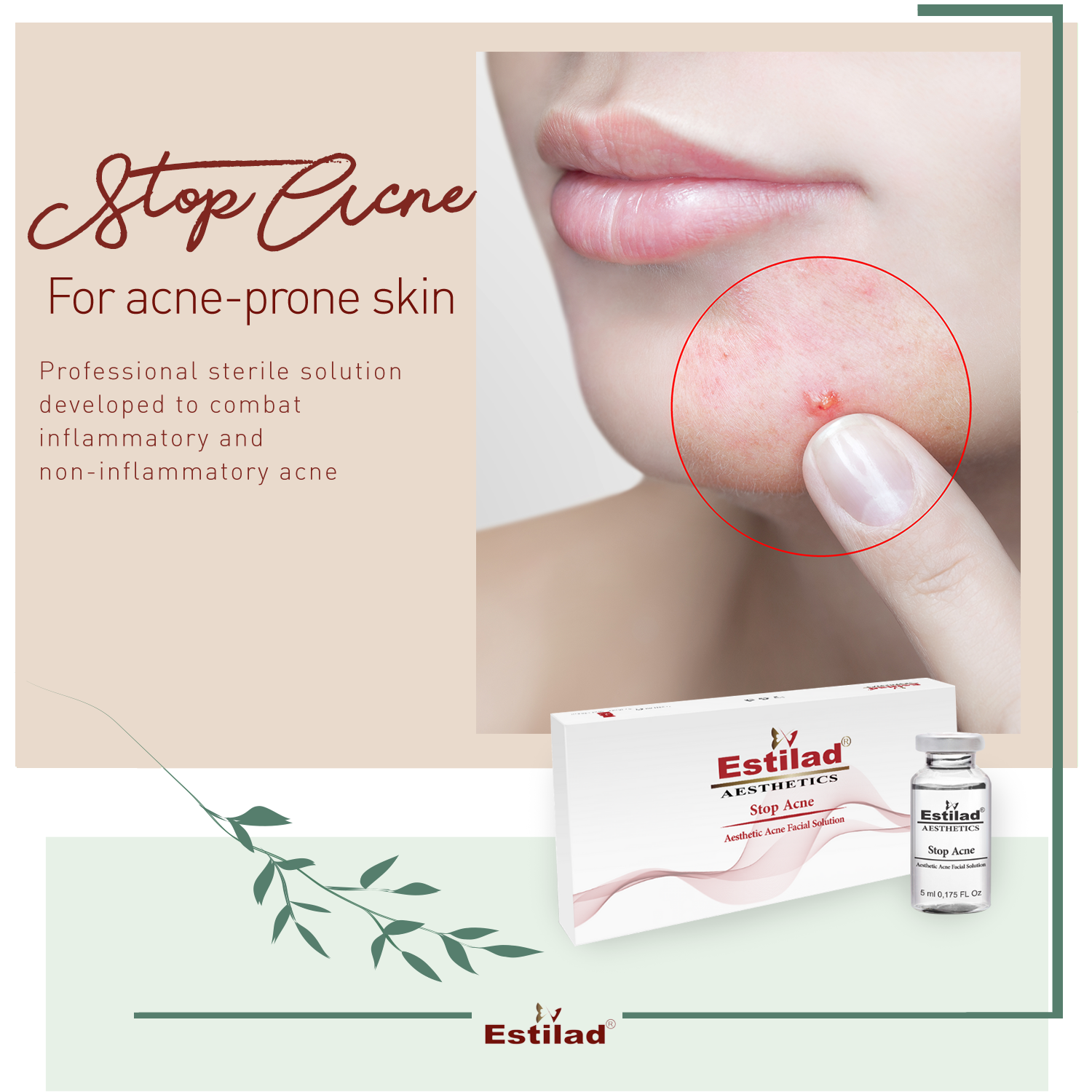 Stop Acne