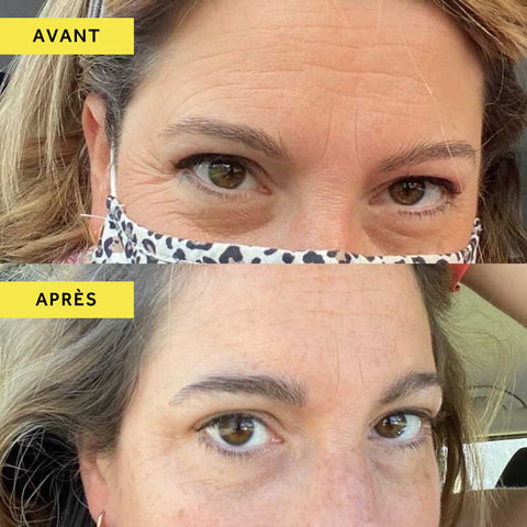 Combien De Temps Faut Il Pour Qu Elixir De Collagene Agisse Absolute Collagen France