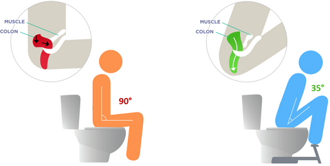 Soigner Les Hemorroides Grace A Une Meilleure Position Aux Toilettes La Boutique Des Wc