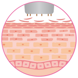 Stamper Step 1
