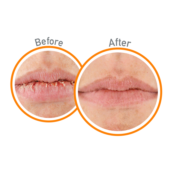 O Keeffe S Lip Repair Lip Balm Unscented Ellington Agway