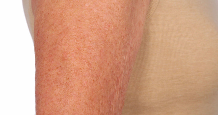 The Sculpt Arm Compound U Beauty