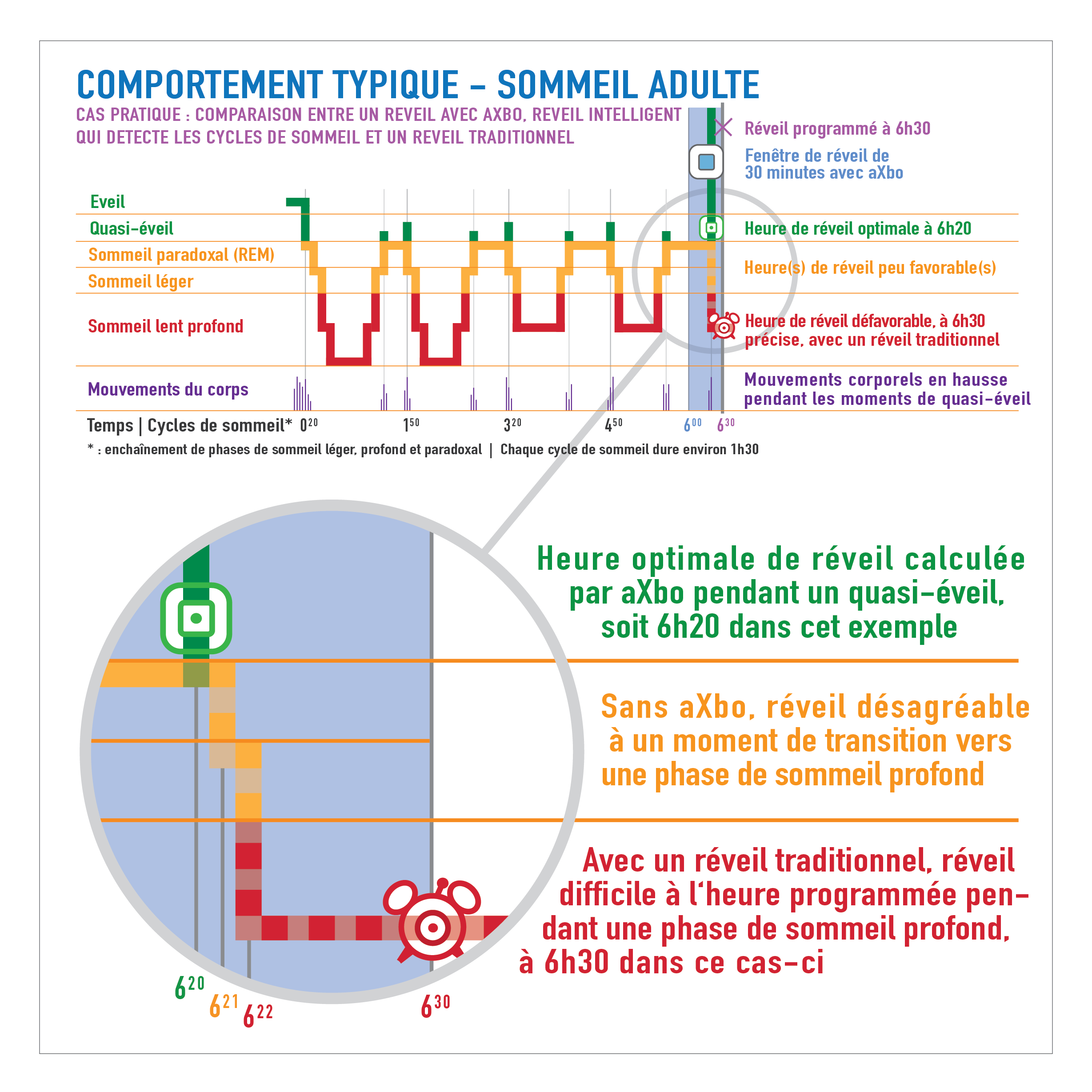 Hypnogramme Axbo France