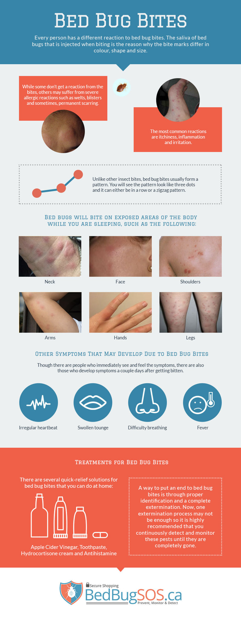 Bed Bug Bites Bed Bug Sos