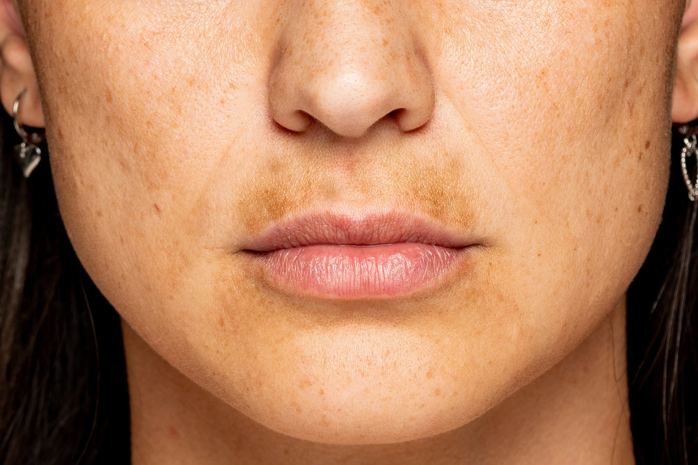 Uneven Skin Tone 5 Tips For How To Fix Uneven Skin Tone Colorescien Colorescience