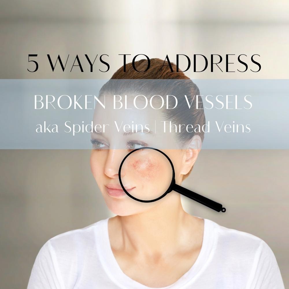 5 Ways To Address Broken Blood Vessels On Your Face The Skin Lab