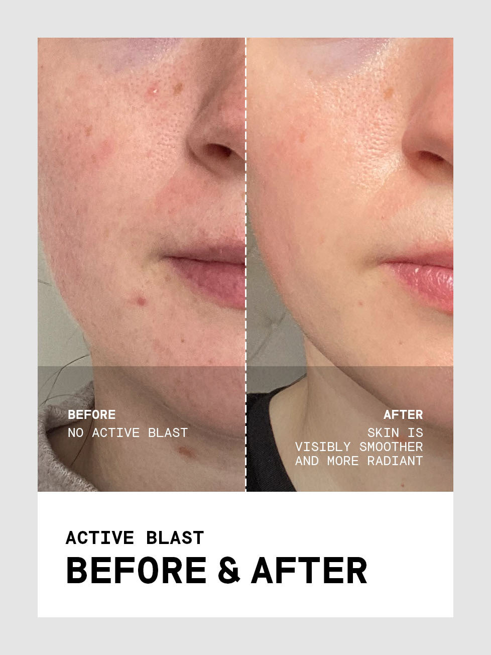 Active Blast Skincare Facegym Usa