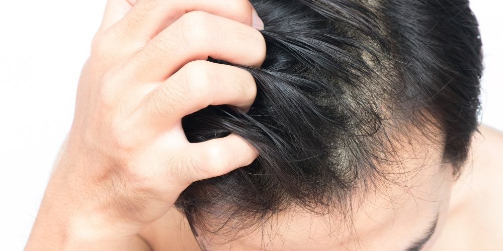 How To Treat Your Itchy Scalp Fast Vitaman Vitaman Usa