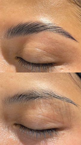 Boka Ett Brow Lift Rapide