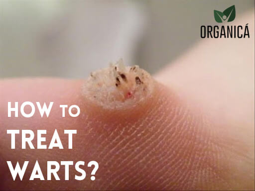 How To Treat Warts Organica Organica Phil