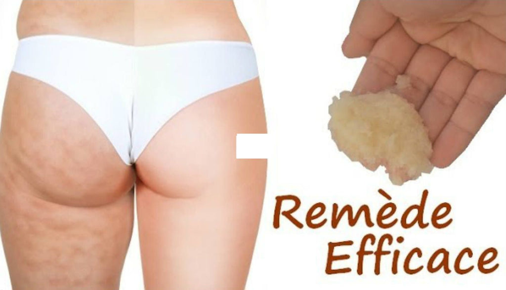 Est Il Possible De Se Debarrasser De La Cellulite Comment Se Debarra My Skincare