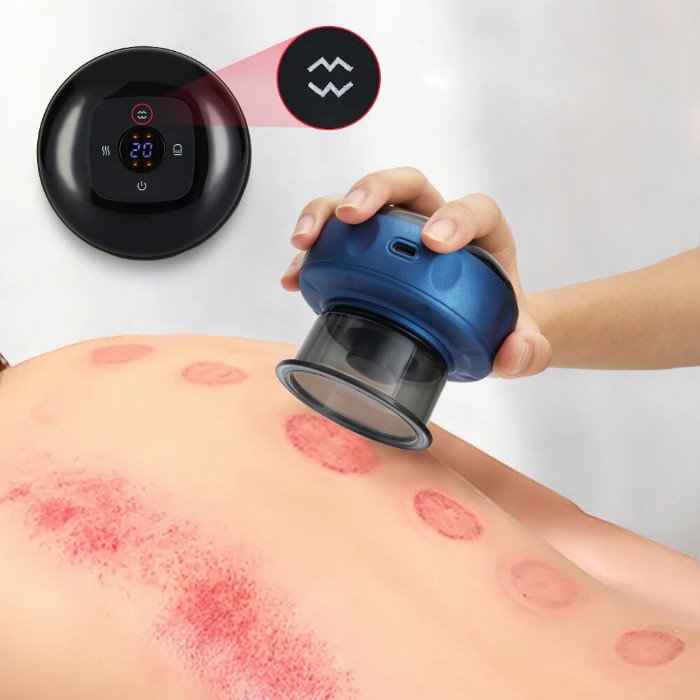 Ventouse Electrique Anti Cellulite Fit Super Humain