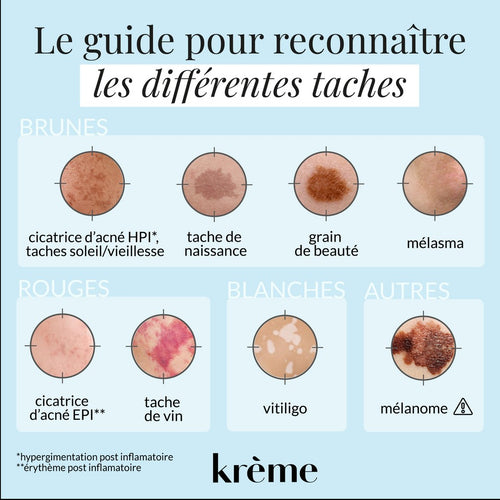 Taches Brunes Sur Le Visage Le Guide Pour Les Attenuer