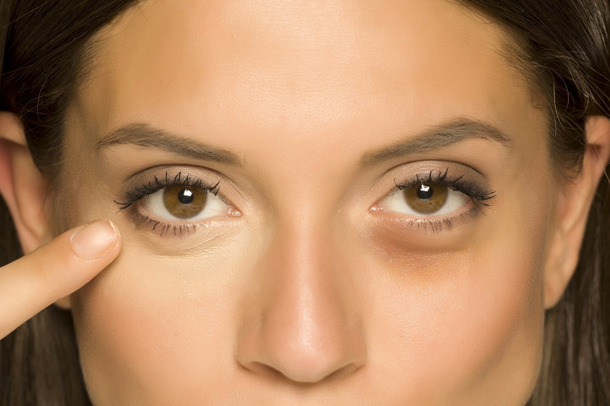 Learn How To Get Rid Of Eye Bags Readingglasses Com