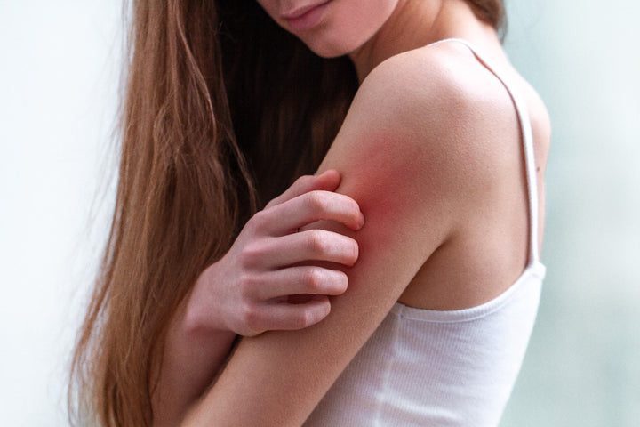 Can B12 Deficiency Cause Itching