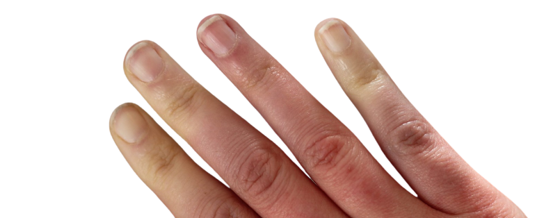 Gants Chauffants Pour La Maladie De Raynaud Conseils Gant Chauffant