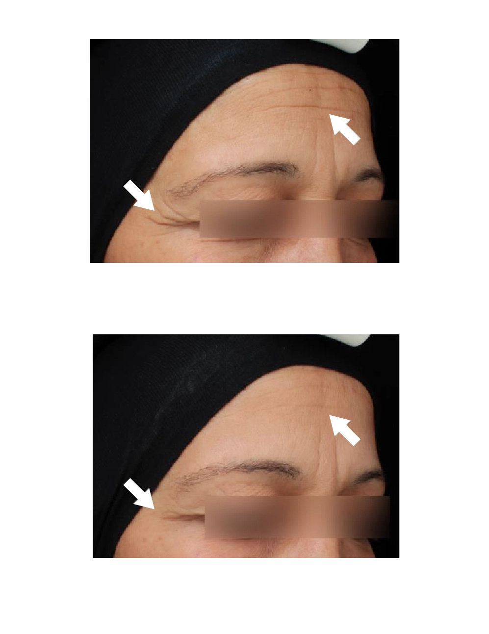 L Appel De La Foret Laboratoire Garancia