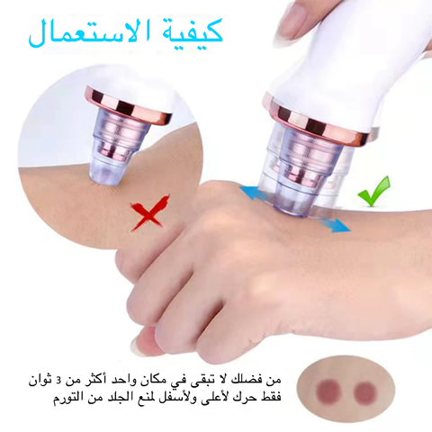 الة إزالة الرؤوس السوداء