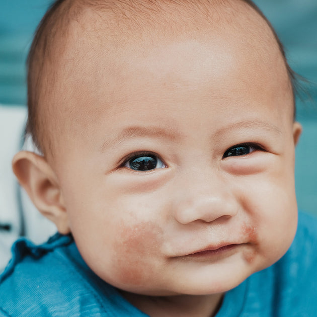 Dermatitis Atopica En Bebes Y Ninos Preguntas Y Respuestas Mustela