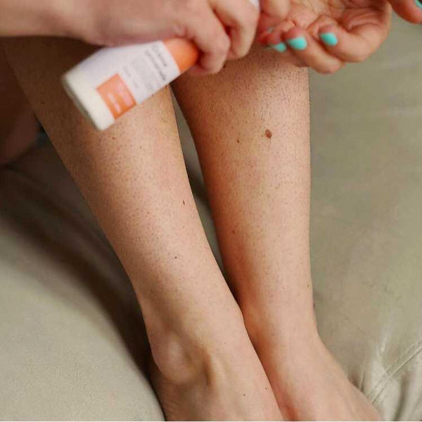 La Peau De Fraise Comment S En Debarrasser Uny