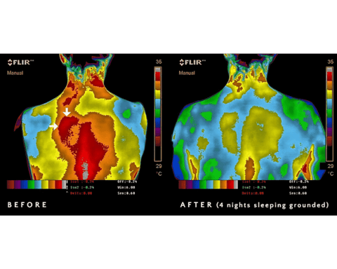 pain decreased from earthing
