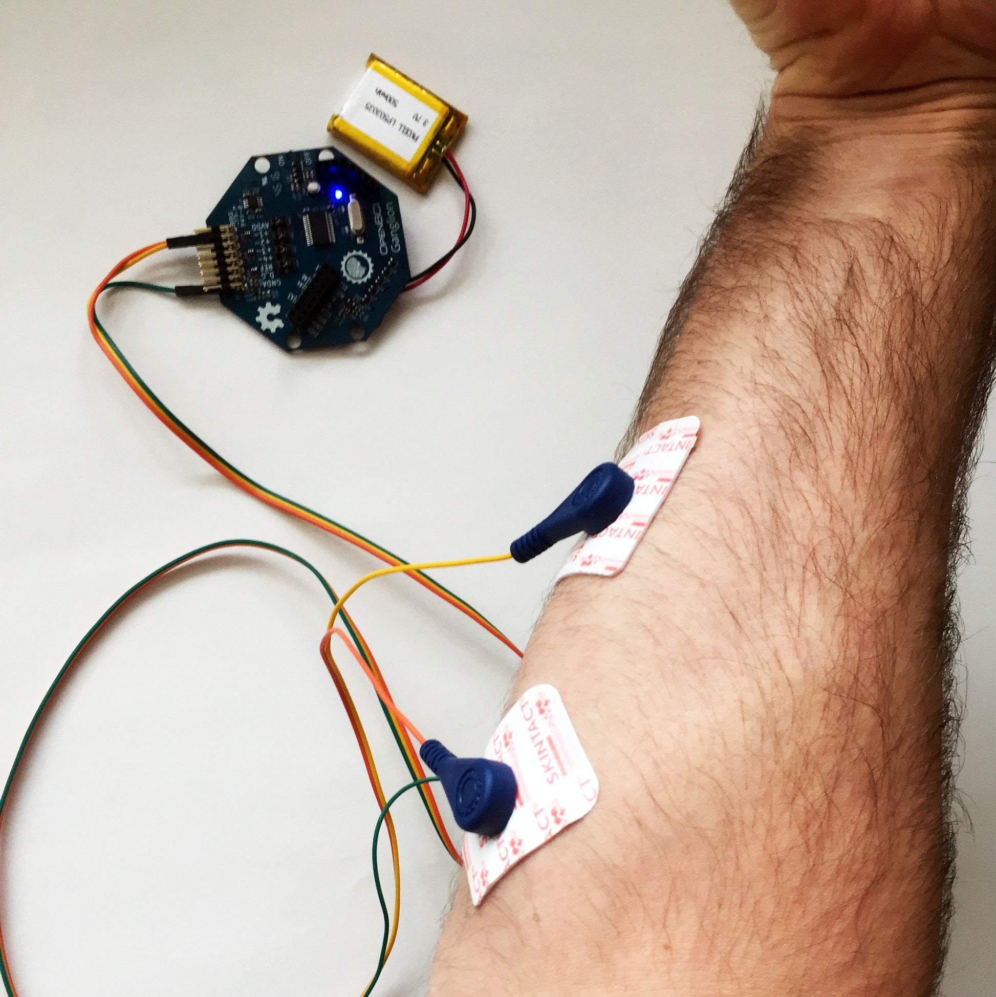 Emg Ecg Snap Electrode Cables Openbci Online Store