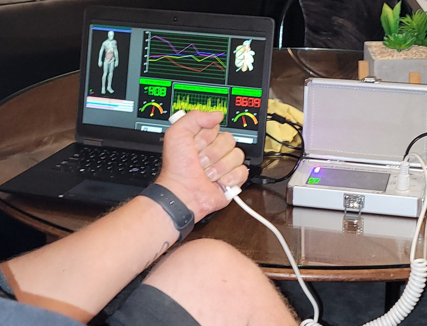 Full Body Health Checkup Using Quantum Resonance Magnetic Body Health Ganoitouchwairarapa