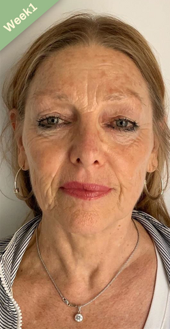 Ren Advanced Collagen Boost Lifting Anti Aging Serum 1 1 Gratis Avello