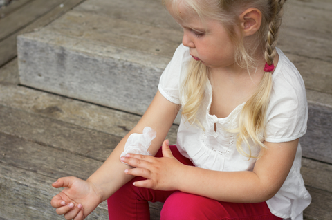 Is It Safe To Use Topical Steroids On My Child Eczema Life