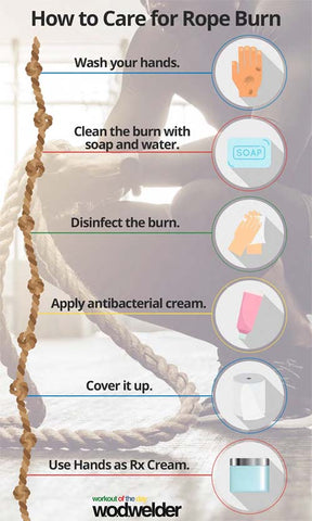 How To Treat Rope Burn Heal Care For Your Hands With Wod Welder