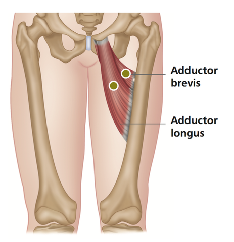 Tendinitis Of The Hip Adductors Stuart Hinds Performance Therapy