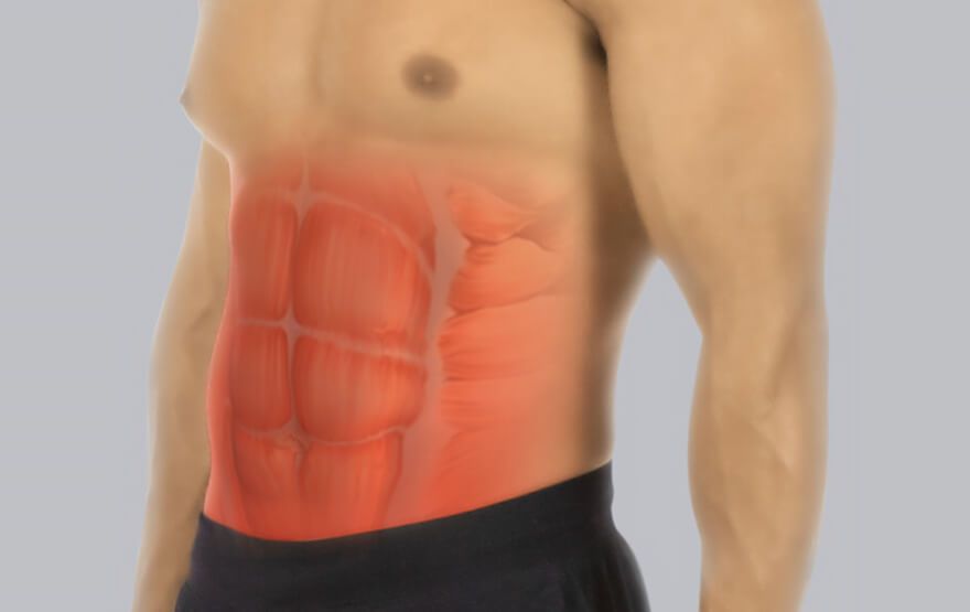Abdominal Muscle Strain Identifying The Pain Vive Health