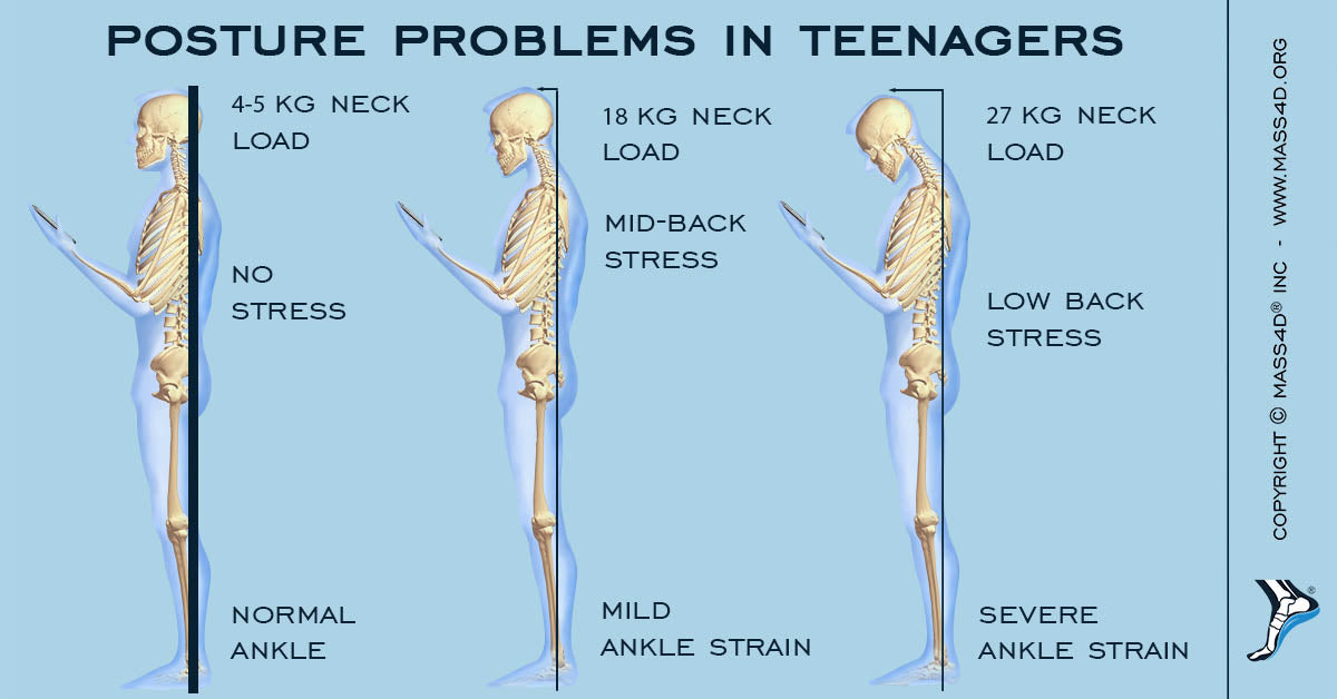 Understanding Posture Problems In Teens Mass4d Foot Orthotics