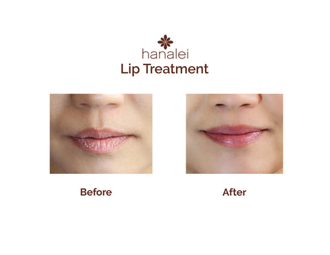 What Is Sugar Lip Scrub And How Do I Exfoliate My Lips Hanalei Company